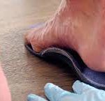 Les orthèses plantaires : une solution efficace pour traiter les pathologies du pied chez l’adulte