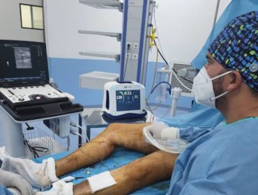 Laser endoveineux